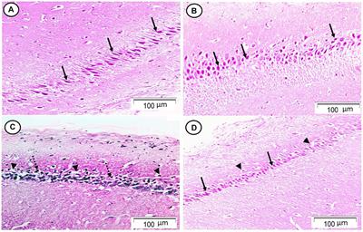 Neuroprotective effect of ranolazine improves behavioral discrepancies in a rat model of scopolamine-induced dementia